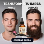 minoxidil uruguay