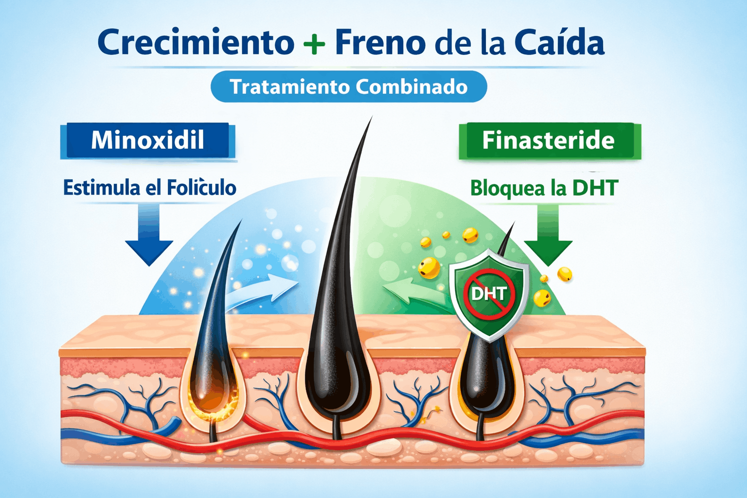 resultados reales minoxidil y finasteride juntos